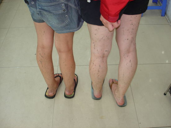 Ja so sieht man aus, wenn man mit Flip Flops durch die regnerischen Strassen von Vietnam laeuft.