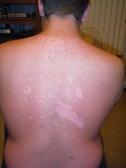 so sieht dann halt der rücken aus, aber macht nix. 