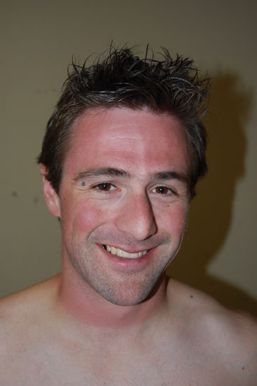 Und so sieht man aus, wenn man es nicht fuer noetig haelt, sich einzucremen.