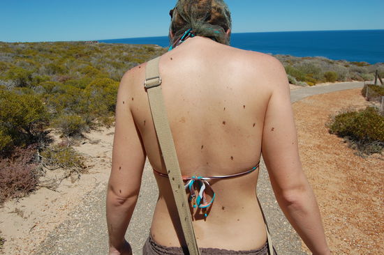 Die schwarzen Punkte sind Fliegen und das sind noch wenige. Wenn man kein Netz ueberm Kopf hat, versuchen die sogar in die Nase, Ohren, Mund oder Augen zu kommen, baehhh.