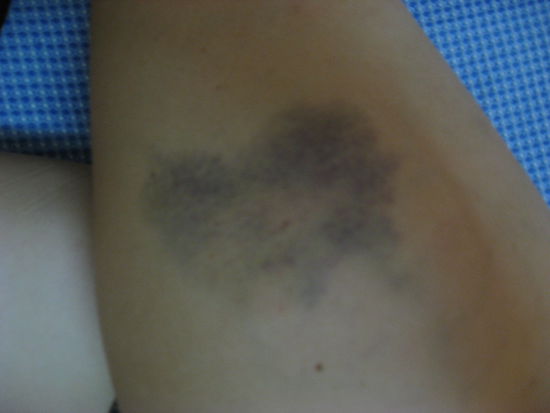 ein Muster eines blauen Flecks 