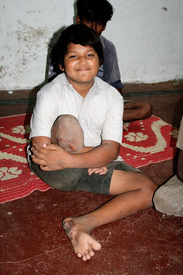 Dieser Junge ist unter einen Zug geraten...