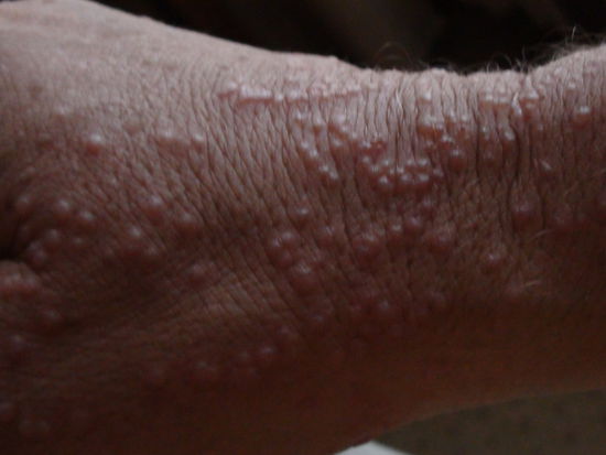 Die Fotos kommen nicht sehr gut rueber. Effektiv siehts noch schlimmer aus!