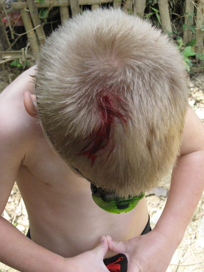 Der Hoehlengeist hat zugeschlagen. Sieht schlimmer aus als es ist.