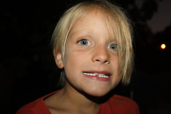 und verliert seinen ersten Zahn!