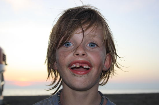 Verlust der Woche: ein Milchzahn!