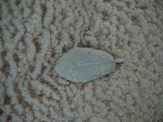 ob Calgon wohl helfen wuerde?