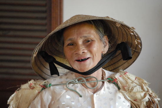 Hier hilft auch kein Bleaching mehr