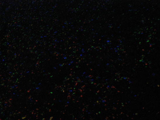 Kleine fluoriszierende Steinchen.