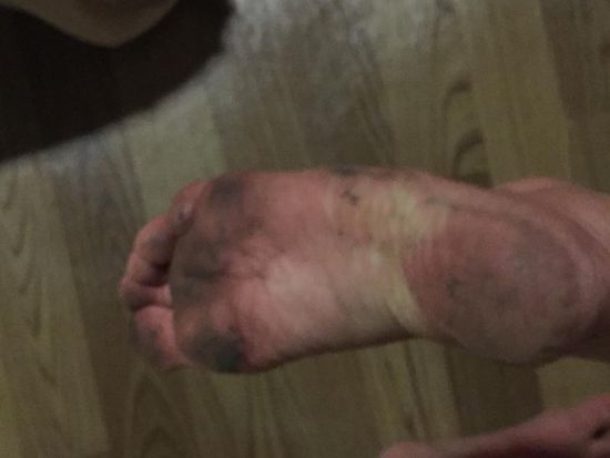 Nach dem Abend auf der Dachterrasse lol