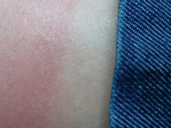 wer erkennts??? das ist die frankreich-flagge, bestehend aus sonnenbrand, hosenabdruck und jeans ...