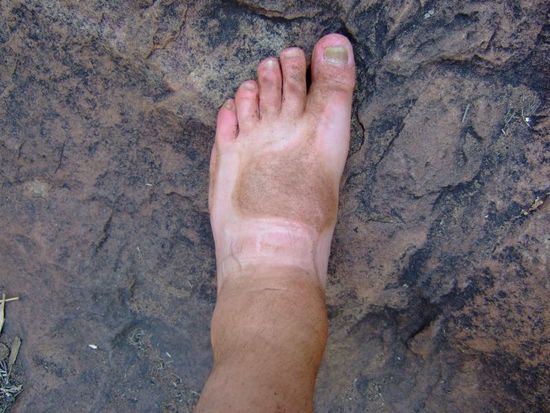 Koerperwaesche war noetig geworden 