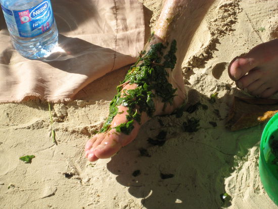 Kraeuter gegen Jellyfish Juckreiz