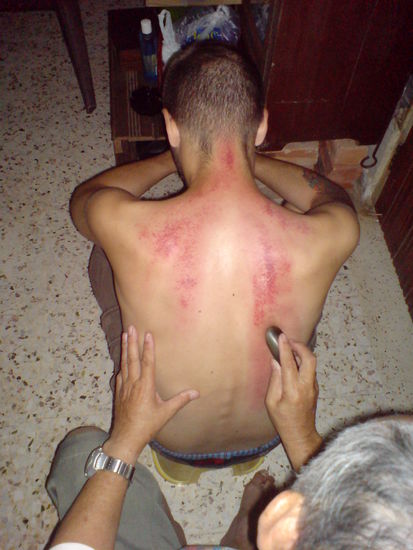 So wird man in China geheilt!