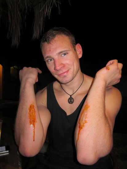 Ich war Mann genug und habe auf jegliche schmerzlindernde Mittel verzichtet. Flo du Prinzessin haha.