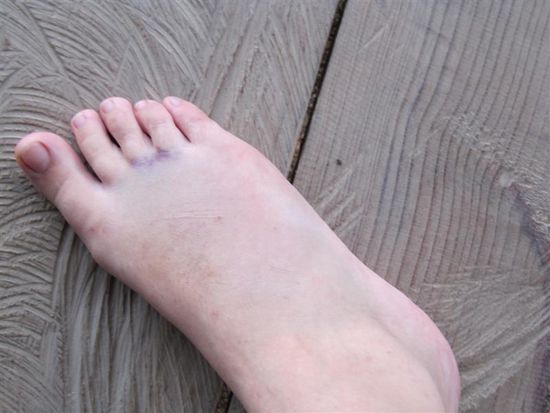 Aus Elefantenfuss wird Regenbogenfuss, oh my buddha