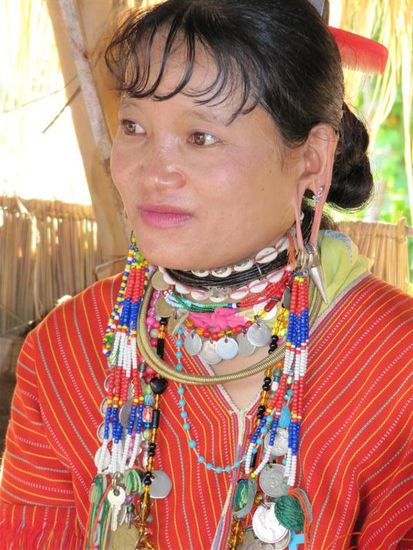 an Michi: Bitte lass dir keinen Tunnel machen, sonst schaust irgendwann so aus.