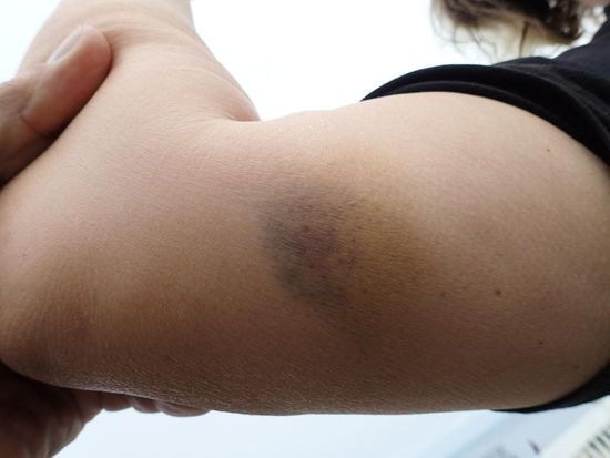 So sieht es aus wenn Margit ungeschickt ist - gut, dass ich das so selten bin 