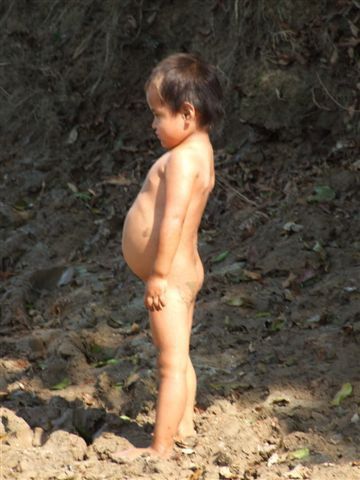 ein typischer blähbauch der jungen generation.