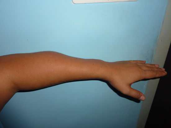 Schoen geschwollen gell?!