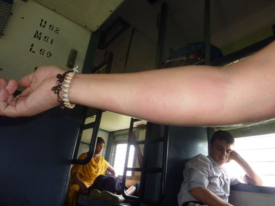 Das war mein kleines Mitbringsel aus Kalkutta. Beim Fruehstueck hat mein Arm ploetzlich gejuckt und dann is er explodiert....
Grad schee war's! Und ist gleich mal ne Woche oder so geblieben mit Juckreiz, selbstverstaendlich! ;$