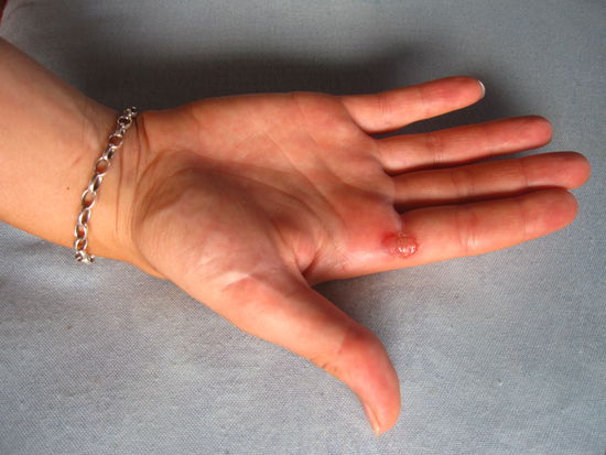 Aber eine echte Dschungelfrau kennt keinen Schmerz... 