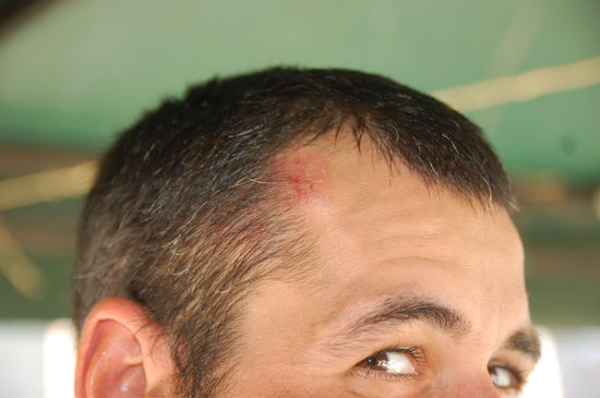 diesmal leider mit doppelten Kopfschuss des crazy japanese dudes..