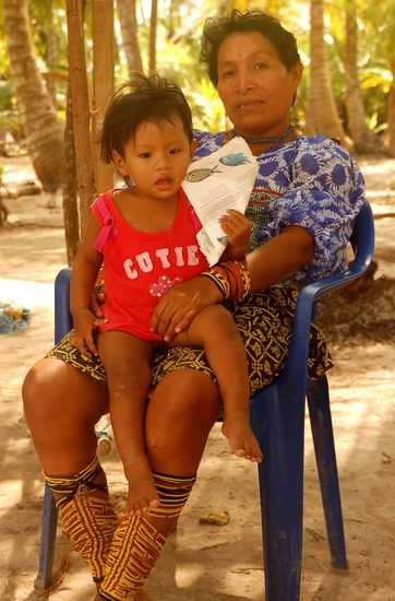 typisch fuer die Kunafrauen ist deren Beinschmuck, der die Frauen wohl attraktiver macht...