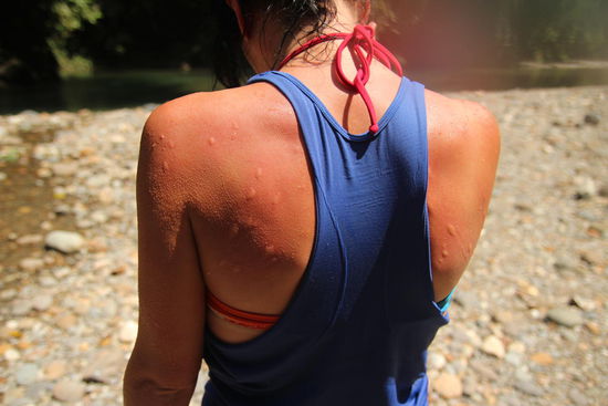 gluecklicherweise fahren die moskitos mehr auf simone ab..