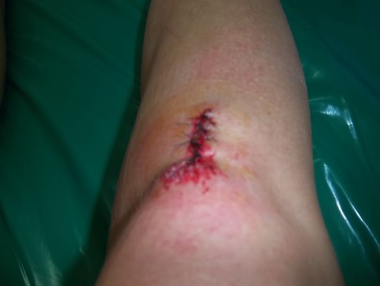 Das ist Sophie´s Knie