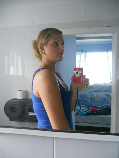 So sieht das aus, wenn man am Arm und im Gesicht von Bedbugs angefallen wird...