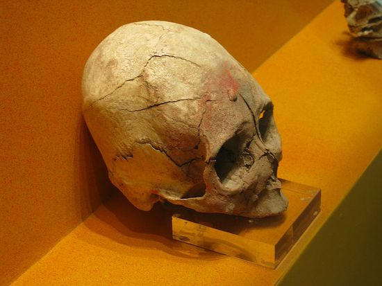 Deformierter Kinderschädel. Durch das permanente Zusammenschnüren konnte die Kopfform in die angesagte Längsform gezwungen werden.