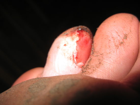 Und wie wir und vor allem unsere Fuesse gelitten haben an diesem langen Wandertag!