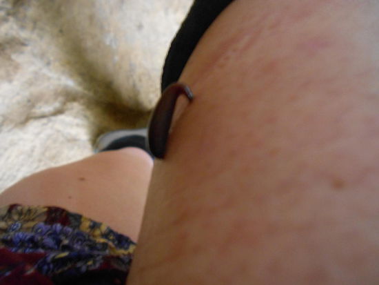 Es tat echt nicht weh, sah nur wirklich nciht nett aus. Der Führer hat mich ausgelacht, weil ich erst das Foto machen musste und erst dann das Viech entfernen wollte Muss doch für euch alle Einsatz zeigen