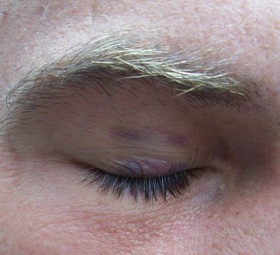 ...und er hat prokmpt ein Veilchen davon getragen 