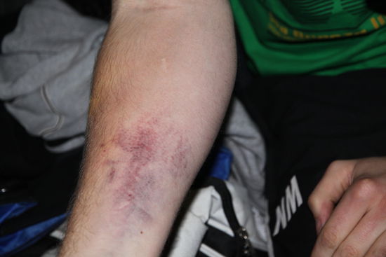 Ergebnis von SIEBEN Versuchen EINEN Zugang zu legen (1 Tag später)