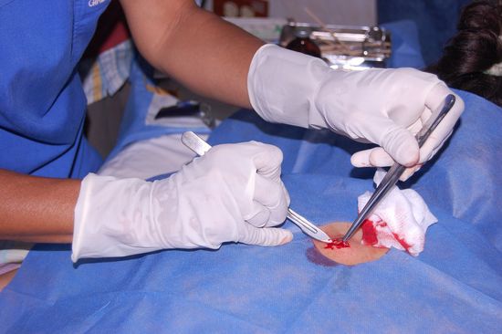 Dann geht die wilde Herumschneiderei los.
Ach nein, Moment, da fehlt ja noch was. Nur was?