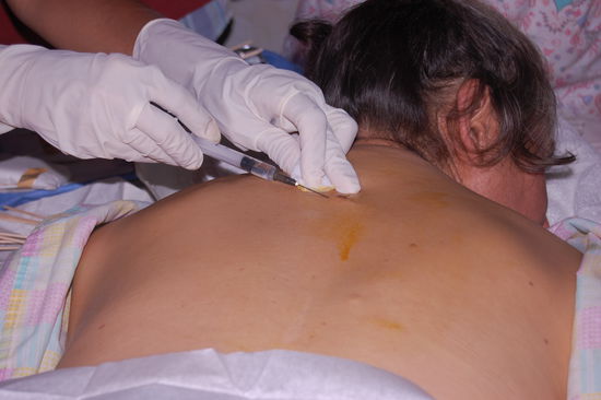 Das geht tief unter die Haut...autsch! 