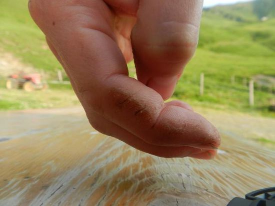Melkfinger