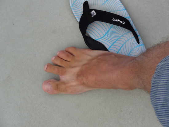 3 Monate Flip Flops hinterlassen so ihre Spuren!