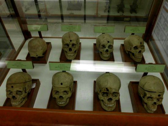 Schädel mit Schussverletzungen im Sirirat Medicine Museum... die anderen Bilder sind nicht zumutbar.