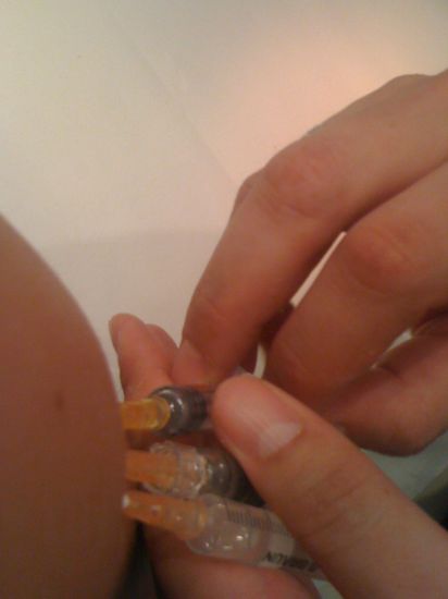 links mein Arm - rechts die Hände von Onkel Doc