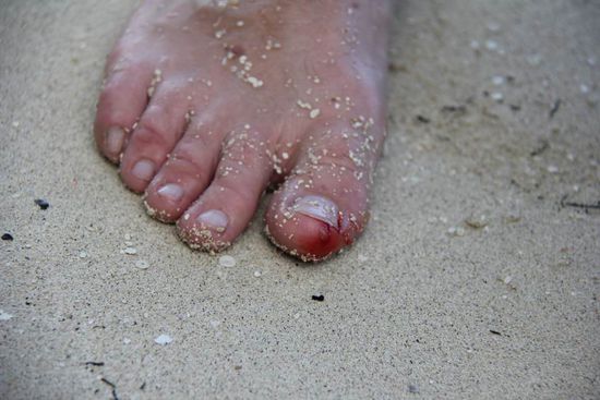 Kein Steinfisch wie im Film, "nur" ein Stein... aber der Wille zählt! 