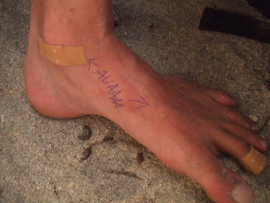 nicht AUVA sondern Auaaaaaaaaa 