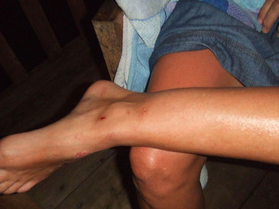 resultat....eigentlich schaut ned mehr schlimm aus.....gottseidank!