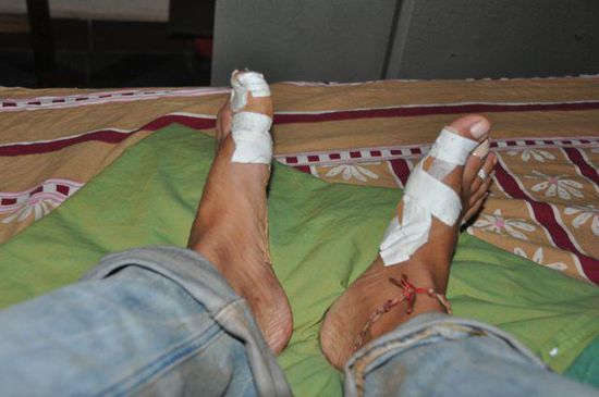 Fight with the Rocks....