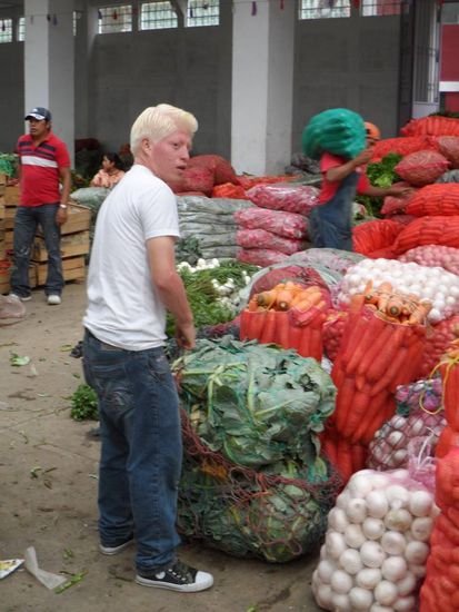 In Zunil gibt es auffallend viele Albinos. Einer Theorie nach koennte die Verwendung von Spritzmitteln beim Gemueseanbau hierfuer verantwortlich sein. Schutzkleidung ist hier oftmals ein Fremdwort. In vielen Faellen tragen die Frauen bei der Arbeit noch nicht mal Schuhe.  Neben den Albinos gibt es wohl auch eine erhoehte Rate von Kindern mit koerperlichen oder geistigen Behinderungen 