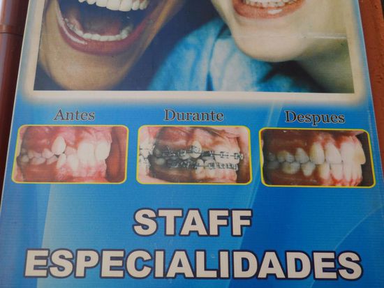 Und zum Schluss noch ne Zahnbehandlung gefaellig?
(vor - waehrend - nach der Behandlung)