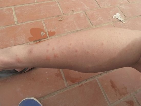 Ganz kann man sich die Mosquitos leider nicht vom Leib halten