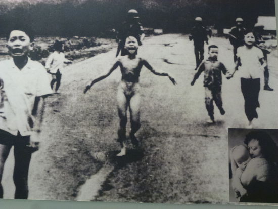 Die Narben beim Menschen bleiben, auch wenn sich das Leben danach scheinbar noch glücklich wandelt
(unten rechts ist das schreiende nackte Mädchen Phan Thi Kim Phuc mit ihrem eigenen Kind abgebildet). Sie hat den Napalangriff überlebt, aber wie sieht die Seele aus???